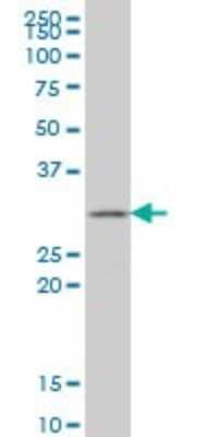 Western Blot: GSTZ1 Antibody (1G12) [H00002954-M01]