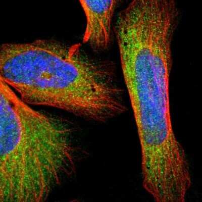 Immunocytochemistry/ Immunofluorescence: GSTZ1 Antibody [NBP1-83320]