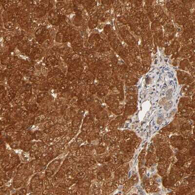 Immunohistochemistry-Paraffin: GSTZ1 Antibody [NBP1-83320]