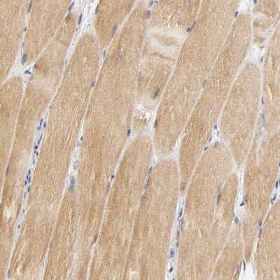 Immunohistochemistry-Paraffin: GSTZ1 Antibody [NBP1-83320]