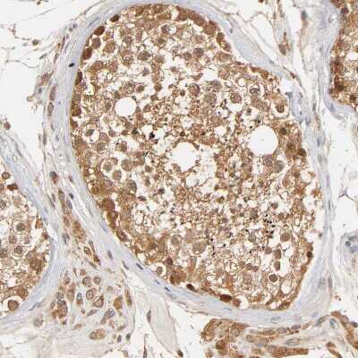 Immunohistochemistry-Paraffin: GSTZ1 Antibody [NBP1-83320]