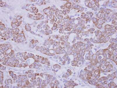Immunohistochemistry-Paraffin: GTDC1 Antibody [NBP2-16759]