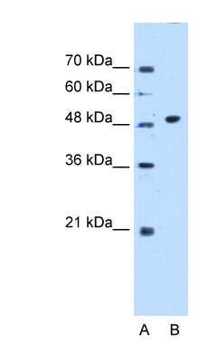 Western Blot: GTDC1 Antibody [NBP1-53078]