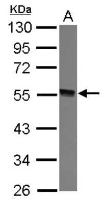 Western Blot: GTDC1 Antibody [NBP2-16758]