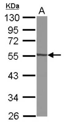 Western Blot: GTDC1 Antibody [NBP2-16759]