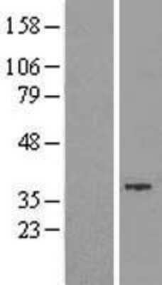 Western Blot: GTDC1 Overexpression Lysate [NBL1-11381]