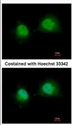 Immunocytochemistry/ Immunofluorescence: GTF2A1 Antibody [NBP2-16760]