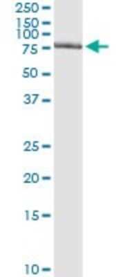 Immunoprecipitation: GTF2A1L Antibody (2E3) [H00011036-M02]