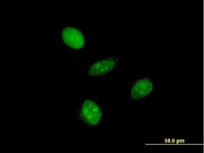 Immunocytochemistry/ Immunofluorescence: GTF2A1L Antibody (3E4) [H00011036-M05]