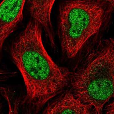 Immunocytochemistry/ Immunofluorescence: GTF2A2 Antibody [NBP2-55408]