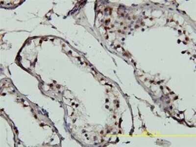 Immunohistochemistry-Paraffin: GTF2H1 Antibody (1F12-1B5) [H00002965-M01]