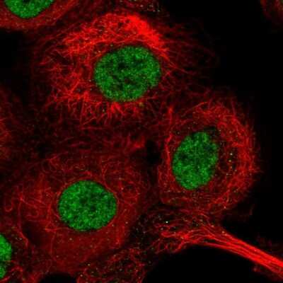 Immunocytochemistry/ Immunofluorescence: GTF2H1 Antibody [NBP2-38556]