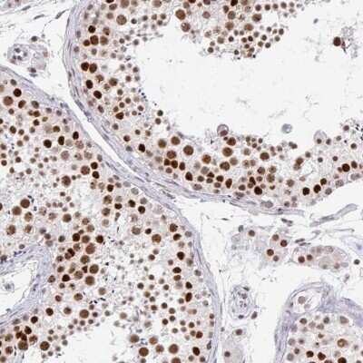 Immunohistochemistry-Paraffin: GTF2H1 Antibody [NBP2-38556]