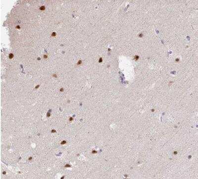Immunohistochemistry-Paraffin: GTF2H1 Antibody [NBP2-38556]