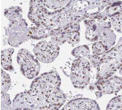 Immunohistochemistry-Paraffin: GTF2H1 Antibody [NBP2-38556]