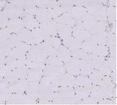 Immunohistochemistry-Paraffin: GTF2H1 Antibody [NBP2-38556]