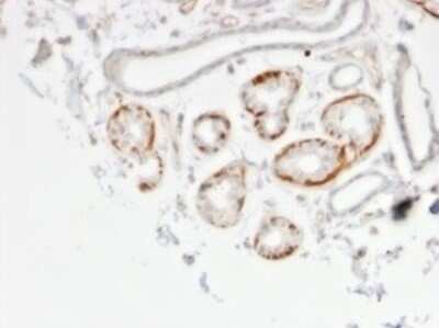 Immunohistochemistry-Paraffin: GTF2H2C Antibody (PCRP-GTF2H2C-2C9) [NBP3-07154]