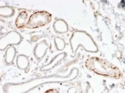 Immunohistochemistry-Paraffin: GTF2H2C Antibody (PCRP-GTF2H2C-2C9) [NBP3-07154]