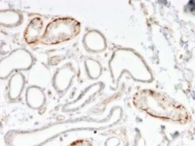 Immunohistochemistry-Paraffin: GTF2H2C Antibody (PCRP-GTF2H2C-2C9) - Azide and BSA Free [NBP3-08896]