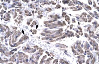 Immunohistochemistry: GTF2H3 Antibody [NBP2-87539]