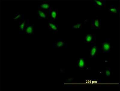Immunocytochemistry/ Immunofluorescence: GTF2H4 Antibody [H00002968-B01P]