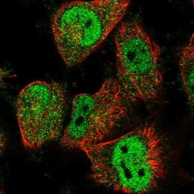 Immunocytochemistry/ Immunofluorescence: GTF2IRD1 Antibody [NBP1-91973]