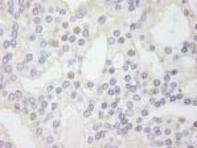 Immunohistochemistry-Paraffin: GTF2IRD1 Antibody [NB100-61055]