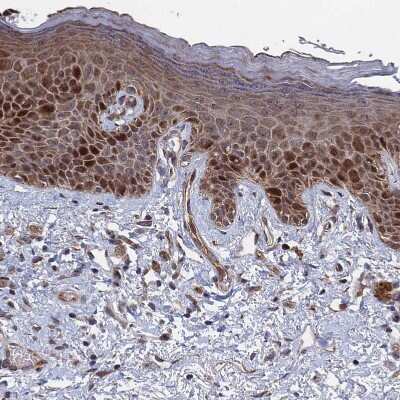 Immunohistochemistry-Paraffin: GTF2IRD1 Antibody [NBP1-91973]