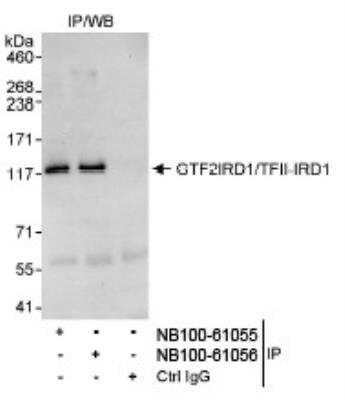 Immunoprecipitation: GTF2IRD1 Antibody [NB100-61055]