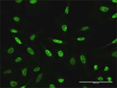 Immunocytochemistry/ Immunofluorescence: GTF3C2 Antibody [H00002976-D01P]