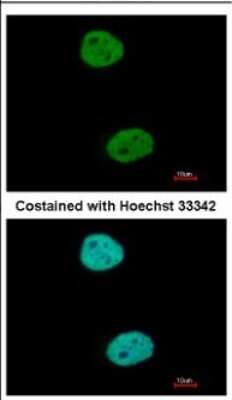 Immunocytochemistry/ Immunofluorescence: GTF3C4 Antibody [NBP2-16763]
