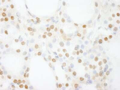 Immunohistochemistry: GTF3C4 Antibody [NB100-60432]