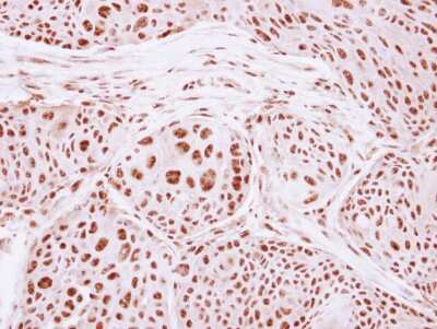 Immunohistochemistry-Paraffin: GTF3C4 Antibody [NBP2-16763]