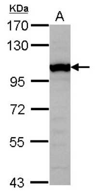 Western Blot: GTF3C4 Antibody [NBP2-16763]