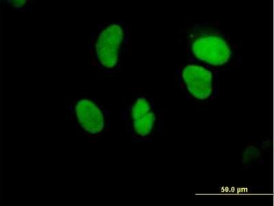 Immunocytochemistry/ Immunofluorescence: GTF3C5 Antibody [H00009328-B01P]
