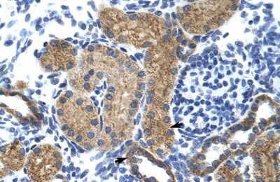 Immunohistochemistry: GTF3C5 Antibody [NBP3-10376]