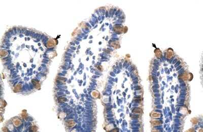 Immunohistochemistry: GTF3C5 Antibody [NBP3-10489]