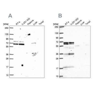 Western Blot: GTF3C5 Antibody [NBP2-49504]