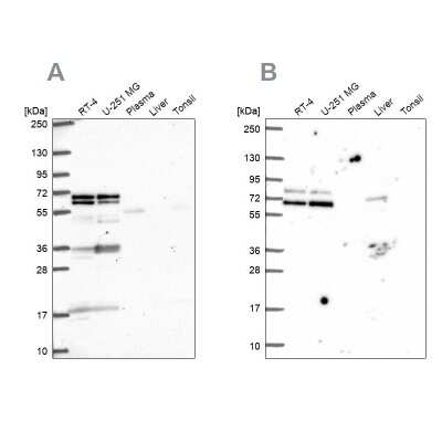 Western Blot: GTF3C5 Antibody [NBP2-55707]