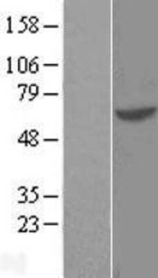 Western Blot: GTF3C5 Overexpression Lysate [NBL1-11396]