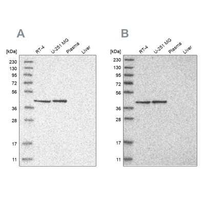 Western Blot: GTP binding protein era homolog Antibody [NBP1-89704]