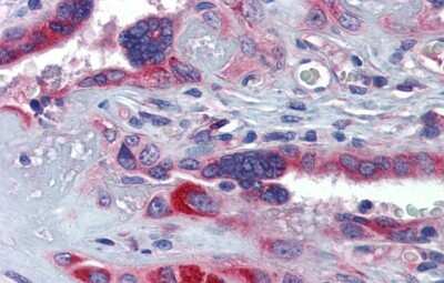 Immunohistochemistry-Paraffin: GTPBP10 Antibody [NBP1-52959]