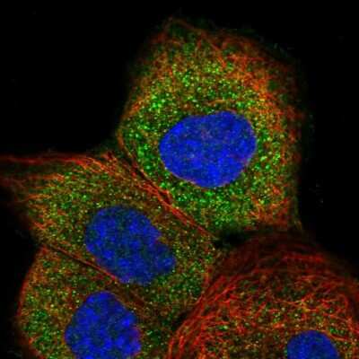 Immunocytochemistry/ Immunofluorescence: GTPBP2 Antibody [NBP1-85924]