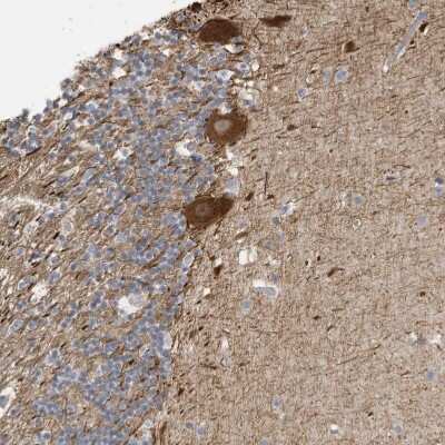 Immunohistochemistry-Paraffin: GTPBP2 Antibody [NBP1-85924]