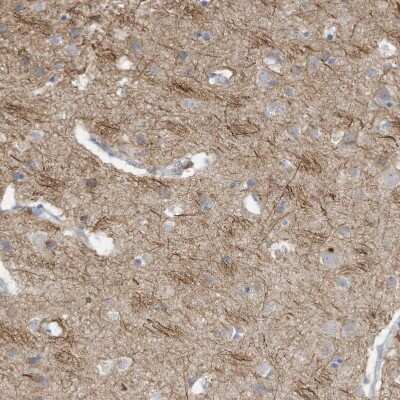 Immunohistochemistry-Paraffin: GTPBP2 Antibody [NBP1-85924]