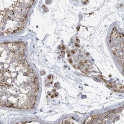 Immunohistochemistry-Paraffin: GTPBP2 Antibody [NBP1-85924]