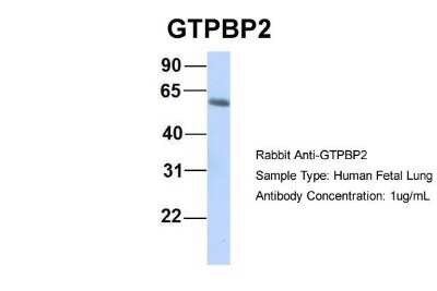 Western Blot: GTPBP2 Antibody [NBP1-57648]