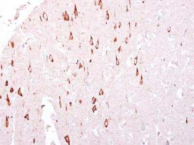 Immunohistochemistry-Paraffin: GTPBP3 Antibody [NBP2-16765]