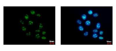 Immunocytochemistry/ Immunofluorescence: GTPBP4 Antibody [NBP2-16766]