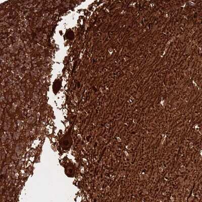 Immunohistochemistry-Paraffin: GTPBP5 Antibody [NBP1-91975]